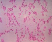 bacteroidesfragilis gram.jpg from gram