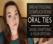 breastfeeding complications oral ties signs symptoms your options jpgis pending load1 from breastfeeding dieu thao 495 days 124 mamma thao