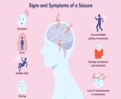 signs and symptoms of epilepsy 1024x646.jpg from epilepsy