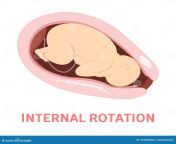 rotation stage baby birth vaginal delivery internal rotation stage baby birth vaginal delivery fetus movement 127026603.jpg from birthcenter ï¼vaginal birth videos