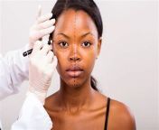 thqunderrepresentation of african americans in plastic surgeryw1200h1200c100rs2qlt100cdv3pidimgdetmain from xxx tonny kakkar sexy lund