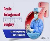 thqacupuncture and penis enlargmentw1200h1200c100rs2qlt100cdv3pidimgdetmain from champa sriyani nakedw xxx aav
