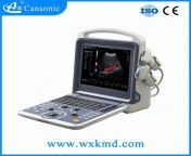 thqdoppler ultrasound chinese translationw1200h1200c100rs2qlt100cdv3pidimgdetmain from sonasy xsexsy videv