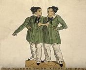 220px chang and eng the siamese twinscoloured etchingwellcome v0007367.jpg from young eng
