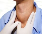 thyroid.jpg from thidoip small