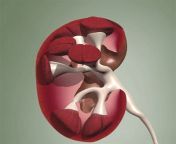kidney image.jpg from kidn