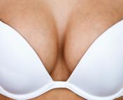 1653074986 transgender breast enlargement basics banner jpgautoformatcompressw1726 from breast expansion transf