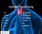 5 causes of your high tsh in woman hypothyroidism that no one is talking about 3 1024x573.png from tsh