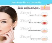 how to use acne patch 3.jpg from how