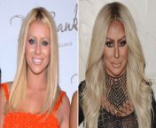 aubrey oday plastic surgery jpgcrop0px0px3231px1830pxresize940529quality86stripall from view full screen braless aubrey plaza takes her dogs out for morning walk 15
