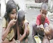 india child malnutrition.jpg from ভারতের 10 বছরের ছেলে 40 বছরের মা বছরের মেয়ে 45 বছরের বাবা hot sexy xmoveisw com deep xxx videos