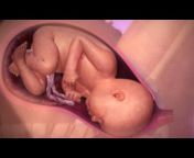 hqdefault.jpg from pregnant lady delivery videos red ap tarzan xxx v