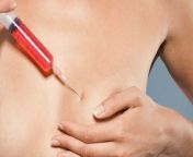 1415729972153 wps 62 woman injecting her breas.jpg from breast injection