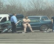 339 from accident nude