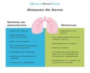 signs of an asthma attack es jpgw1155h2679 from asma