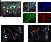 default.jpg from in vivo neuronal labeling by neuo of 1 day postfertilization zebrafish a schematic of q640 jpg