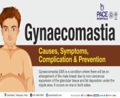gynecomastia symptoms causes complications and prevention 82e20e47 1920w.jpg from gyno pelece exam