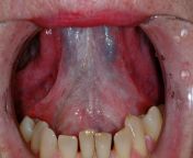 figure1.jpg from crempie mouth