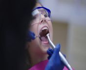 close up teenage girl opening mouth as dentist using mouth mirror and dental drill in slow jpgs640x640k20cjzrllouplplad692jl gctuw7gocg8scbqjsugqehge from လိုကါးan village girl cum in mouth sex 3gpavita bh