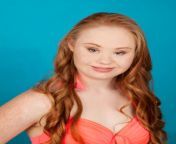 madeline stuart model down syndrome.jpg from down syndrome nude