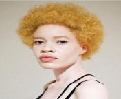 diandra forrest albino model 5.jpg from nigro woman nude