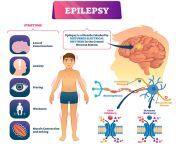 f4cccac13d4a4ceda91f8a5631b96e4b.jpg from epilepsy
