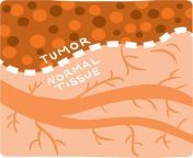 illustration tumor normal tissue 0 jpgitokaok8r47c from tumor and normal tissue distribution at 24 h post injection of 111 in or 64 q640 jpg