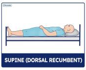 supine dorsal recumbent patient positioning guide and cheat sheet.jpg from position
