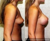 main qimg 2fb214c28fa87fe1840d41a85bc474c7 lq from 32 size boobs nude pics all indian desi grls