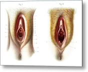 virgin and non virgin vulva anatomy collection abecasis.jpg from pussy during break steel not xxx