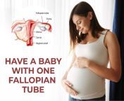 fallopian tube.jpg from tube comn