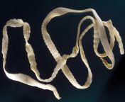 a 1017 tapeworm gkm8ma width 1125.jpg from worm inside pusst