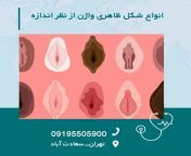 types of appearance of the vagina in terms of size 1024x1024.jpg from انواع کس دختر ب