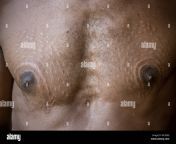 scars on the chest and nipples of a chambri man to look like crocodile skin kanganaman village middle sepik papua new guinea mc3e8g.jpg from village nipple s