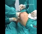 6c78317e514bfa0911dcf1c45895ad51 15.jpg from xvideo sex surgery
