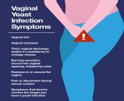 infographic vaginalyeastinfection 1.png from in vag