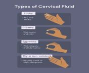 cervical fluid infographic webpv1677535850 from white discharge