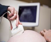 pregnancy ultrasound stock image.jpg from pregnant logan