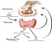 thyroid.jpg from tsh
